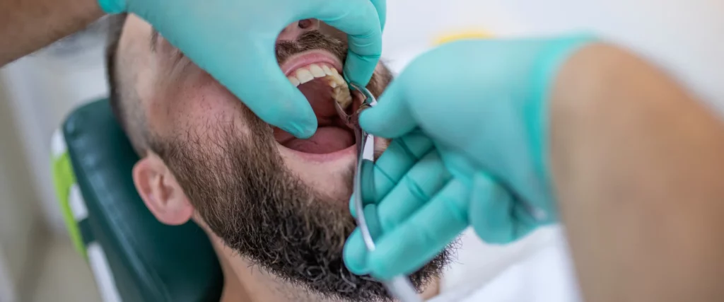a man having a tooth extracted