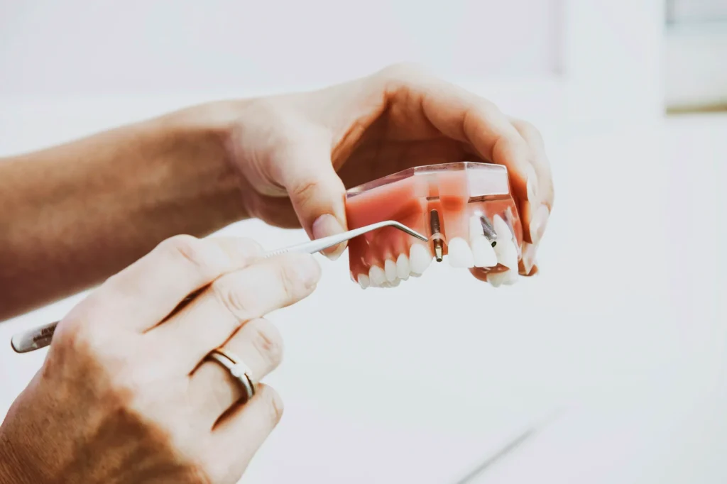 a model of teeth, showing how a dental implant works